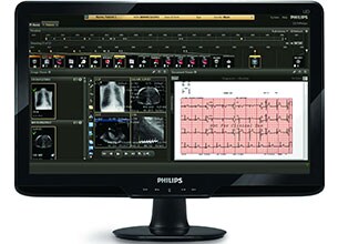 eletrocardiógrafos de pacientes monitorizados em sistema informático Philips CVIS
