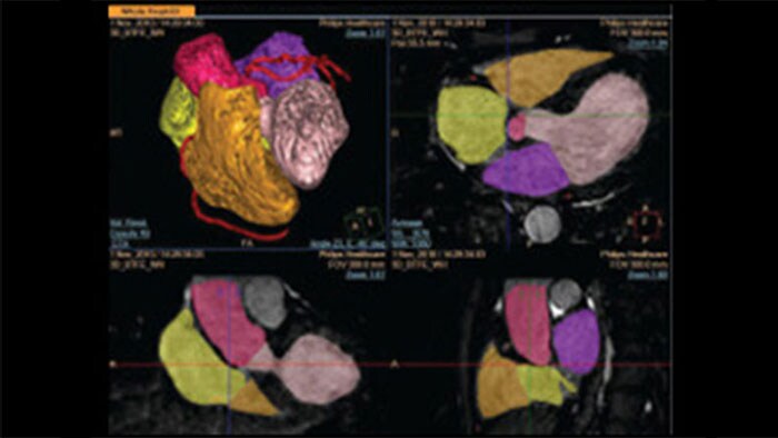 Imagens detalhadas de exames ao coração em 3D