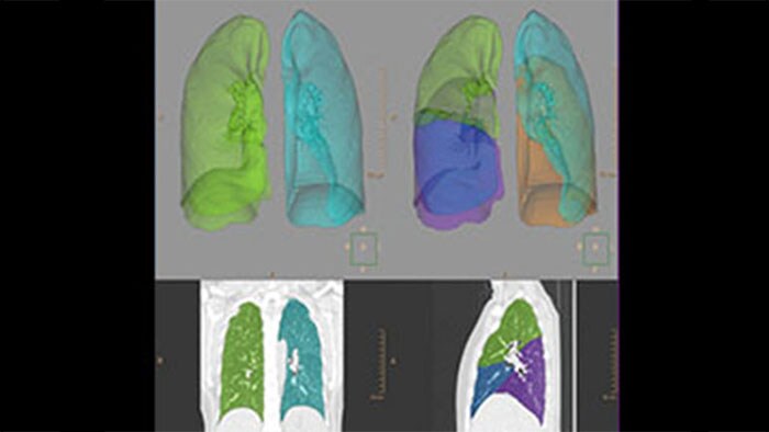 Imagens radiológicas de pulmões humanos