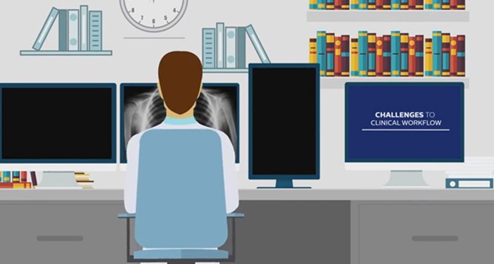 Vídeo da Radiology Workspace Solution
