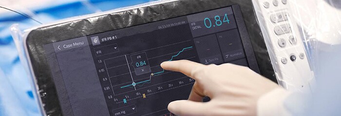 Janela de pop-up iFR para tratamento de CAD