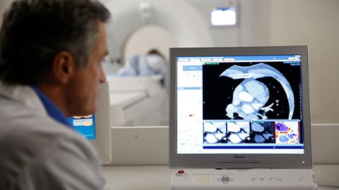 Cardiologista de imagem a utilizar o Spectral CT para diagnóstico por CAD