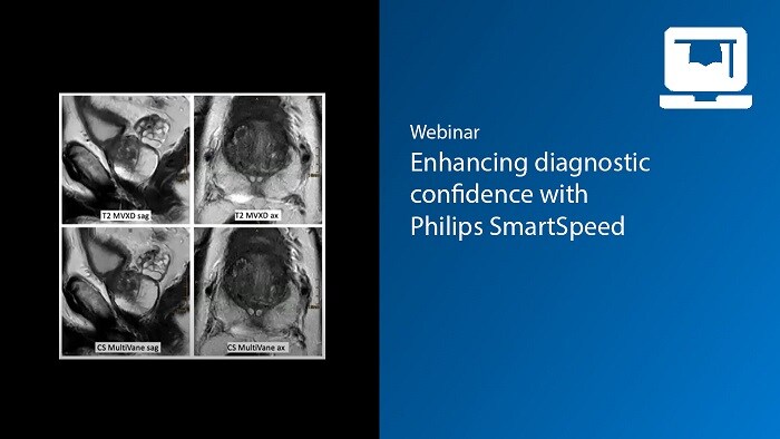 Webinar: Enhancing diagnostic confidence at the University Clinic Bonn with Philips SmartSpeed