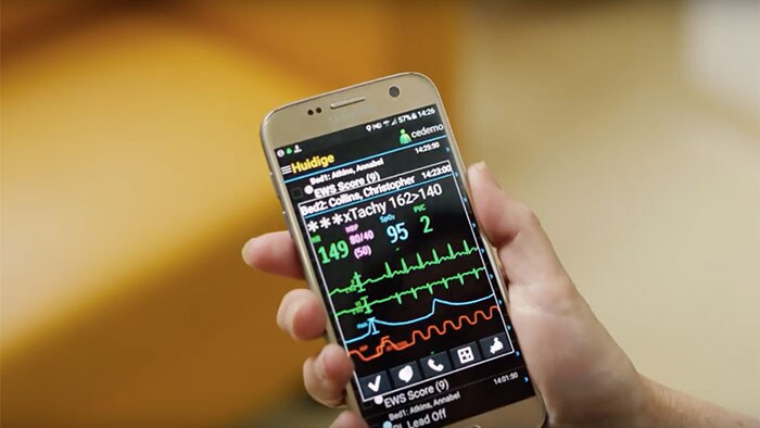 Vídeo Utilizar dispositivos móveis para gerir alarmes de monitorização com o Philips CareEvent