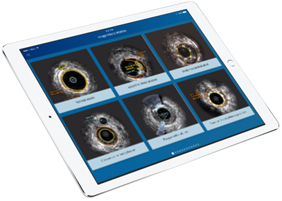 ipad especialista de IVUS