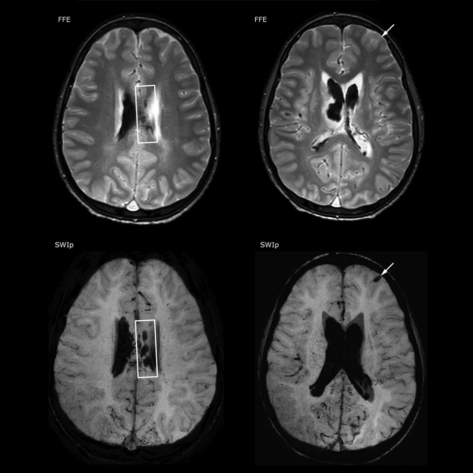 um grande plano de uma tomografia cerebral