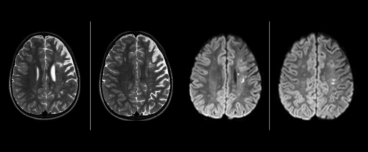 um grande plano de uma tomografia cerebral