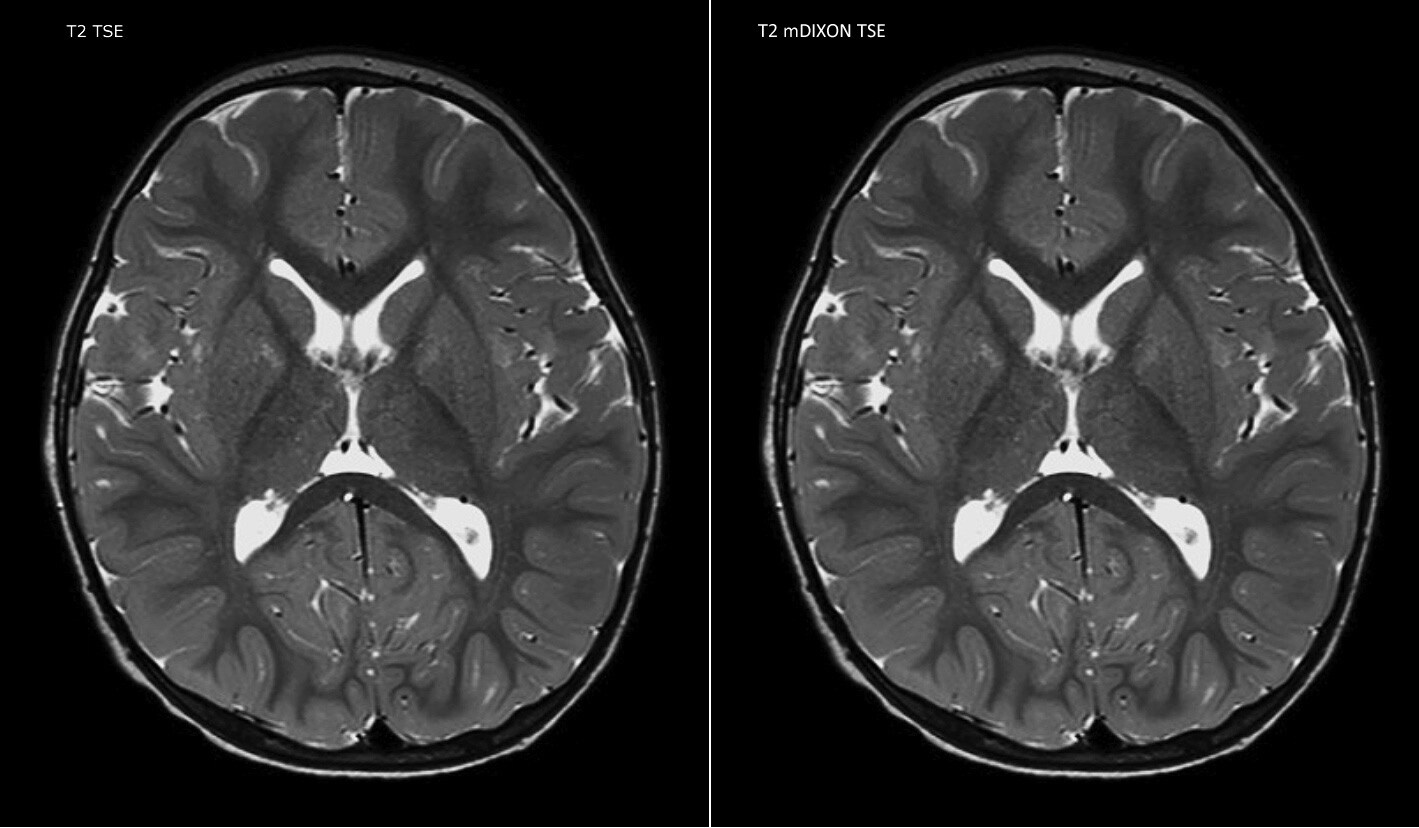 um grande plano de uma tomografia cerebral
