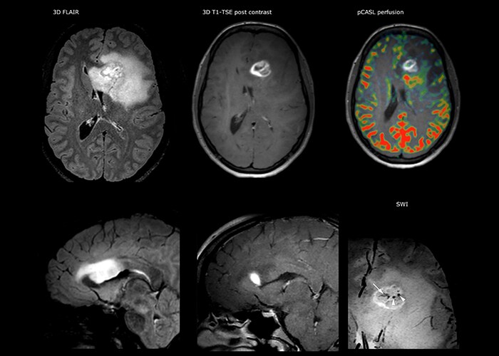 um grande plano de uma tomografia cerebral