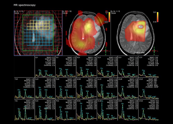 um grande plano de uma tomografia cerebral