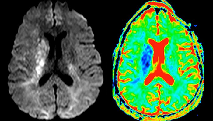 um grande plano de uma tomografia cerebral