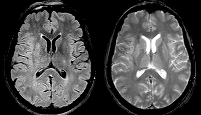 um grande plano de uma tomografia cerebral