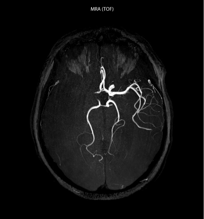um grande plano de uma tomografia cerebral