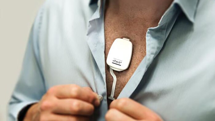 Atrial fibrillation screening: a way toward stroke prevention