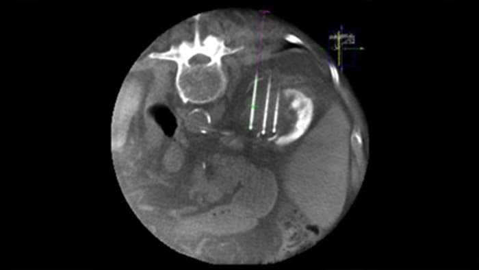 Imagem 3D de CBCT utilizando a vista dupla