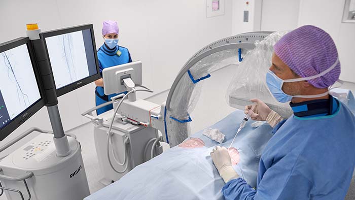 Arcos em C móveis para vascular