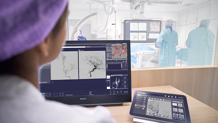 Cuidados neurovasculares