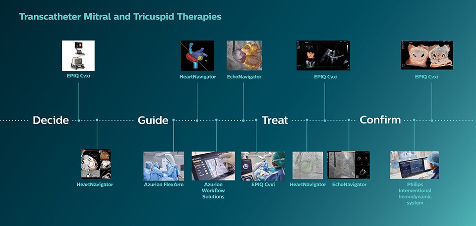 Terapias mitral e tricúspide transcateter