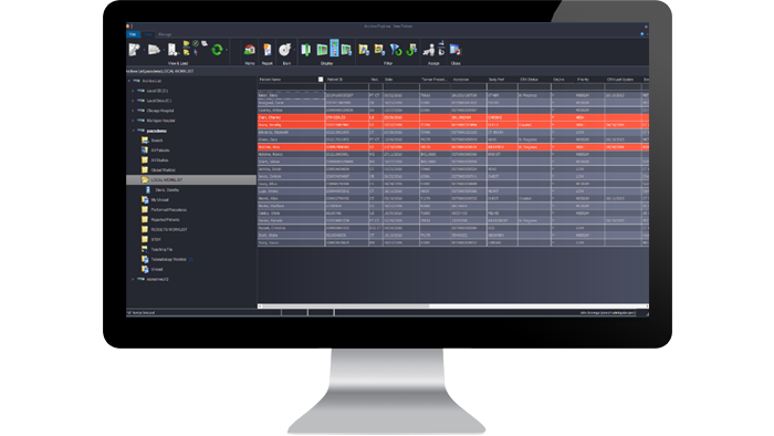 Ecrã da interface da lista de tarefas global num monitor