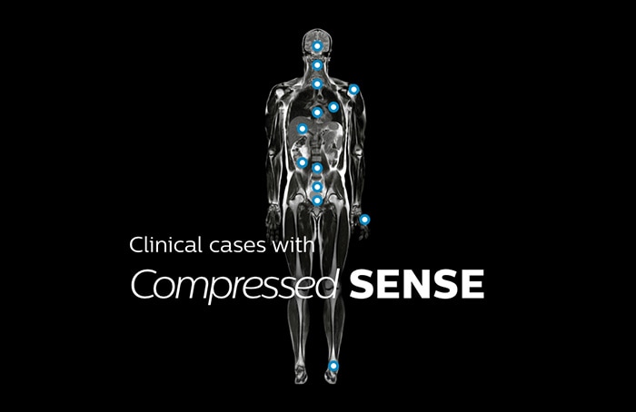 Computador, tablet e telefone com a página do mapa do corpo em RM que mostra casos clínicos de praticamente todas as anatomias