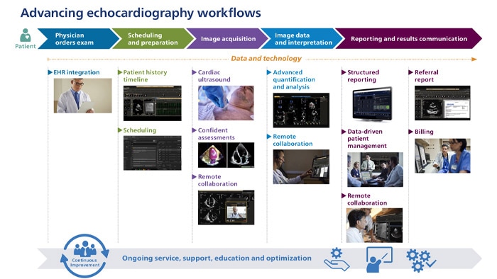 Avanços dos fluxos de trabalho de ecocardiografia