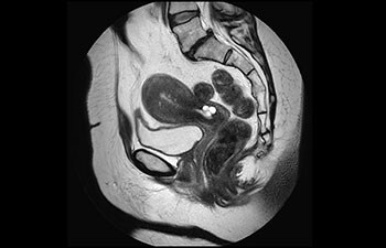 imaging-female-pelvis