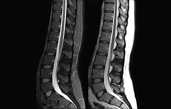 Coluna vertebral