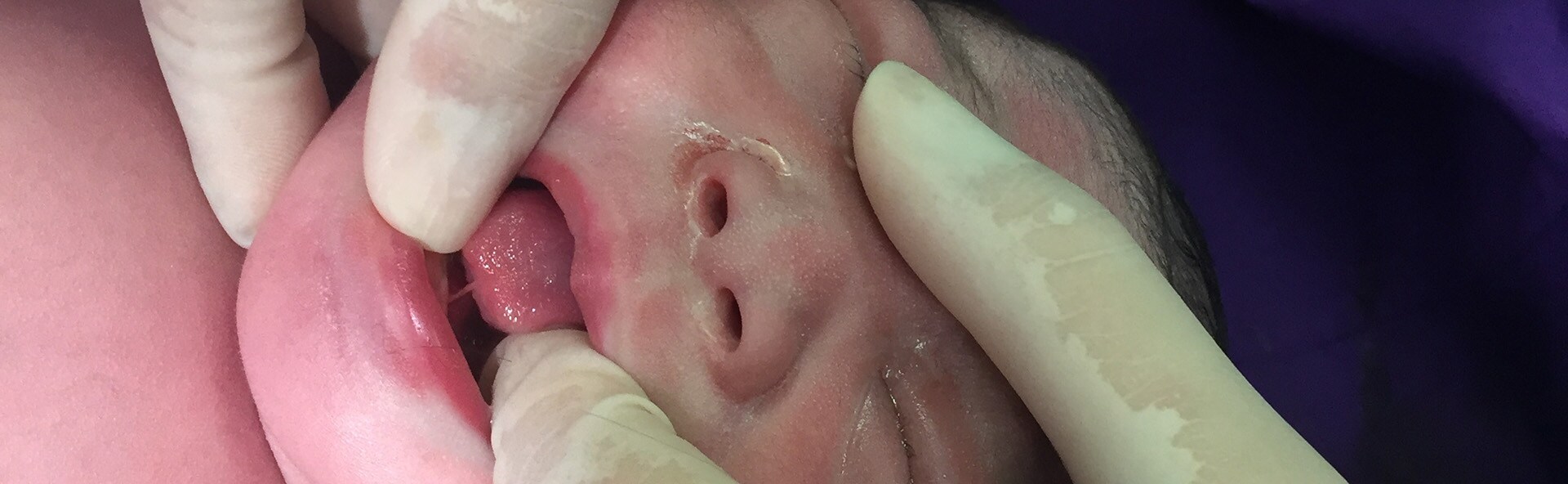 Enfermeira no consultório com uma chupeta