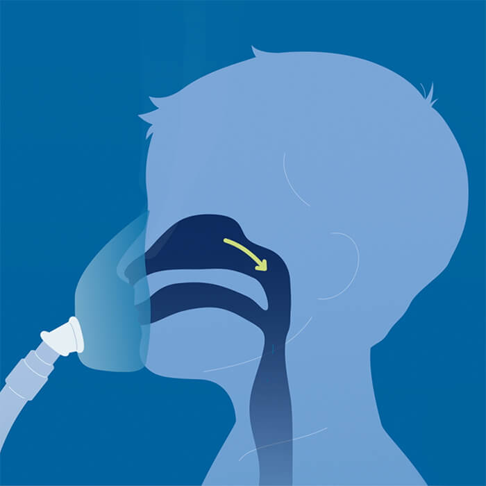 Airway diagram