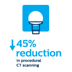 Redução do exame de TAC de procedimento