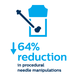 Redução das manipulações da agulha de procedimento