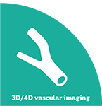 Imagiologia vascular 3D