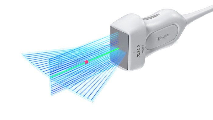 A ecografia vascular do transdutor linear XL14-3 xMATRIX da Philips com Doppler xPlane