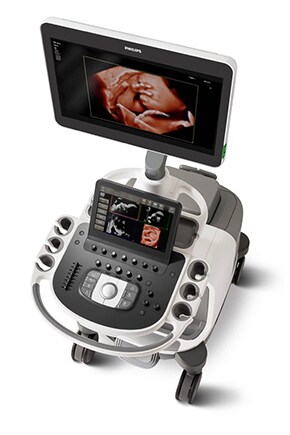 Máquina de ultrassom Epiq 7 para obstetrícia e ginecologia