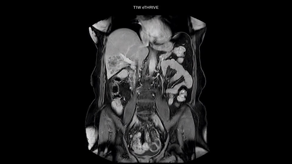 um raio-x ao corpo de uma pessoa