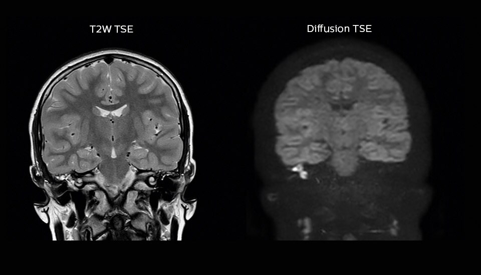 um grande plano de uma tomografia cerebral