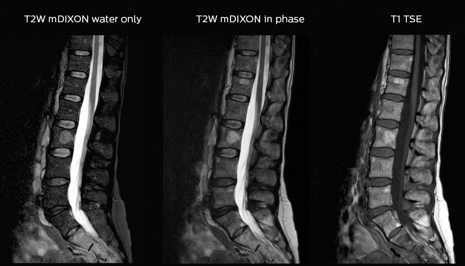 um grande plano de várias radiografias da coluna