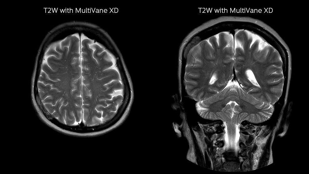um grande plano de uma tomografia cerebral