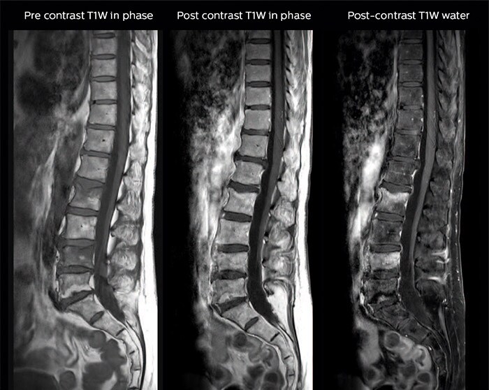 várias imagens de uma coluna vertebral