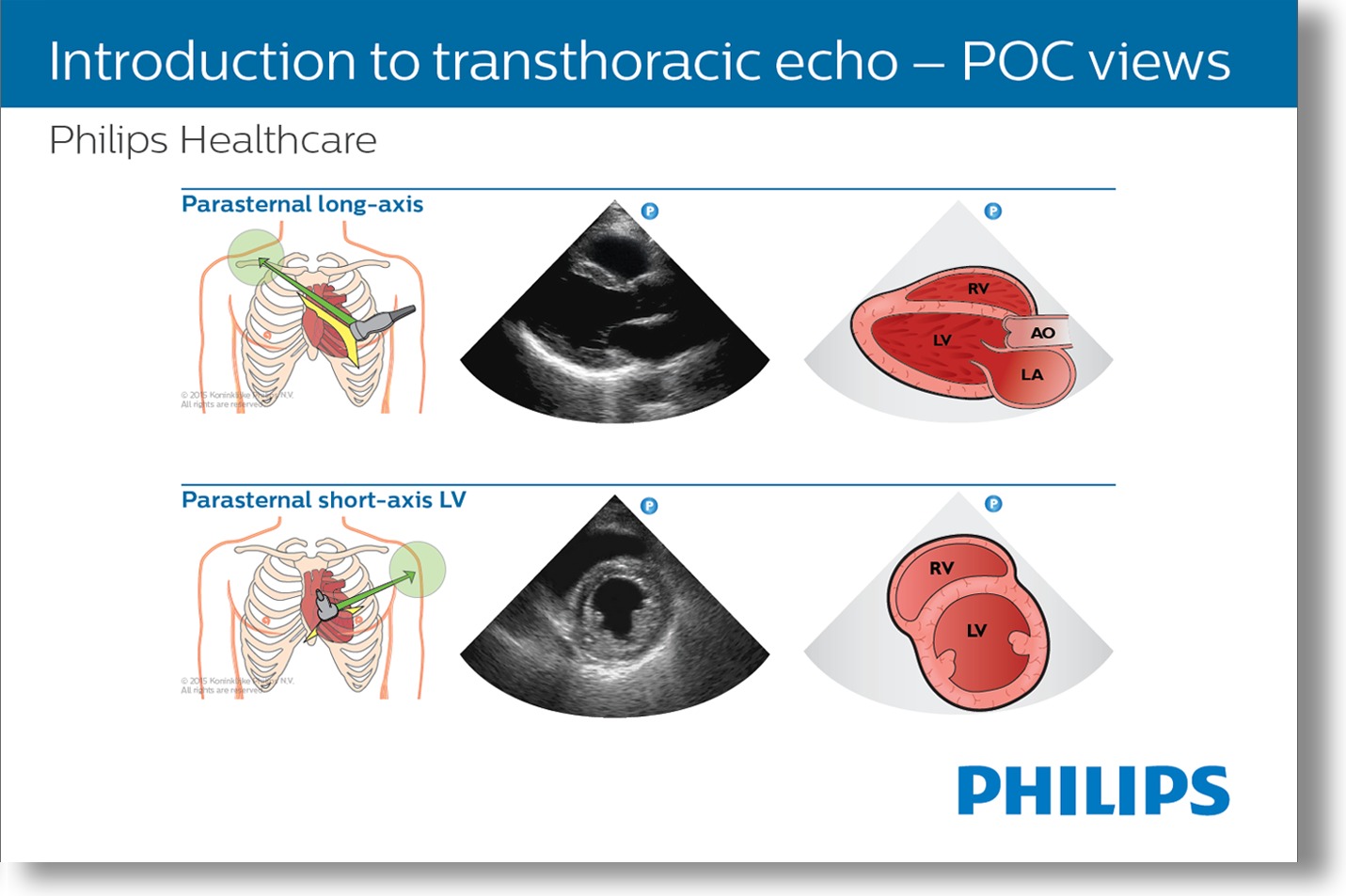 education-ultrasound-critical-care