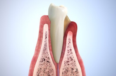 Cuidados dentários urgentes