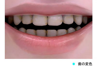 Dentes mais brancos por todo o mundo