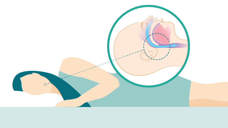 Vias respiratórias desbloqueadas