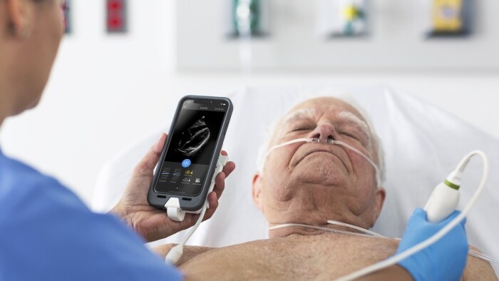 Benefícios do Lumify em cardiologia: quatro case studies que demonstram as suas possibilidades