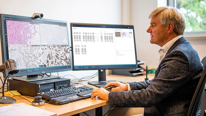 Philips impulsiona a patologia digital com informática avançada para melhorar o diagnóstico de precisão em oncologia