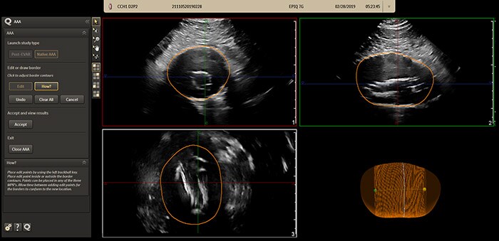 Download image (.jpg) Philips AAA Model (abre em uma nova janela)