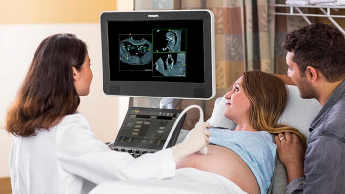 Philips presenta en ISUOG 2022 el software de intercambio de imágenes e informes FetView para ecografía de obstetricia y ginecología