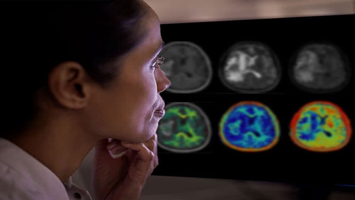 Philips teams with Synthetic MR to deliver breakthrough AI-based quantitative brain imaging in MR to advance neurology care for patients at #ECR2024