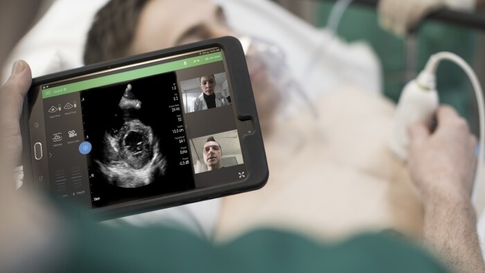 Philips recebe aprovação da FDA para utilização do seu portfólio de ecografia na gestão de complicações cardíacas e pulmonares relacionadas com a COVID-19. 